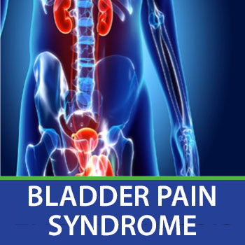 bladder pain slide