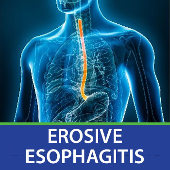 erosive esophagitis slide